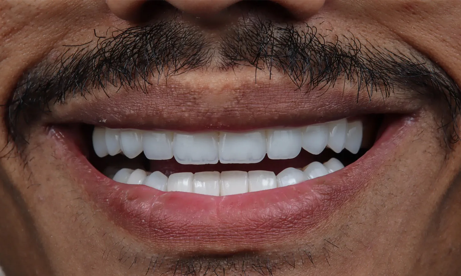 بعد — هوليود سمايل